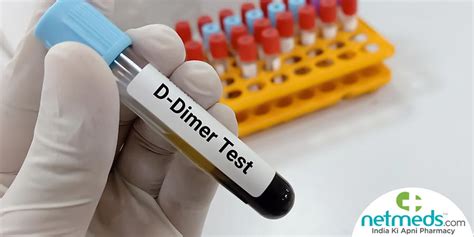 d dimer blood test bottle|d dimer test explained uk.